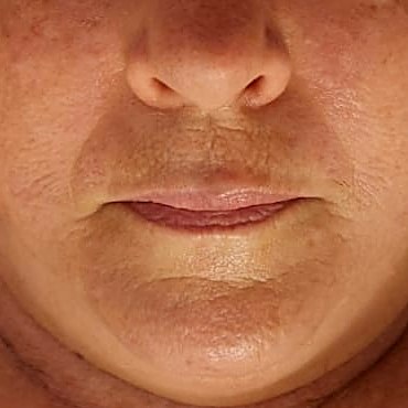 Glowing skin after a facial at Love Thy Skin